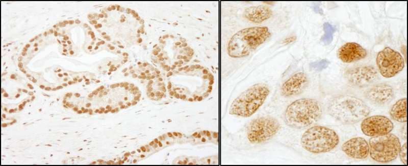 Polyclonal Rabbit anti-Human SF3B1 Antibody (aa200-250, IHC, WB)