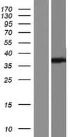 OGG1 Protein (Over-Expression Lysate Myc-DDK (Flag))