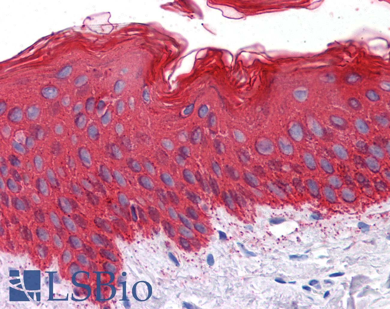 PathPlus™ Pan Cytokeratin Antibody (clone 7H8C4)