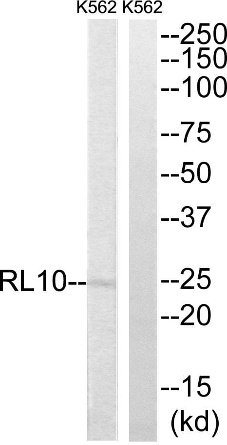 RPL10 / Ribosomal Protein L10 Antibody