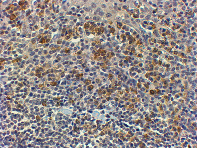 Polyclonal Goat anti-Human MYD88 Antibody (Internal Region, IHC, WB)
