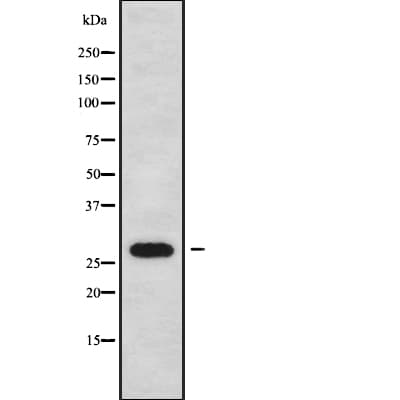 FBP / FOLR2 Antibody