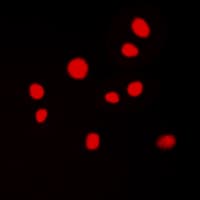 Polyclonal Rabbit anti-Human ATRIP Antibody (N-Terminus, IHC, IF, WB)