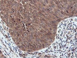 RNPEP Antibody (clone OTI2G3)