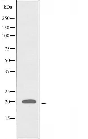 RPL28 / Ribosomal Protein L28 Antibody