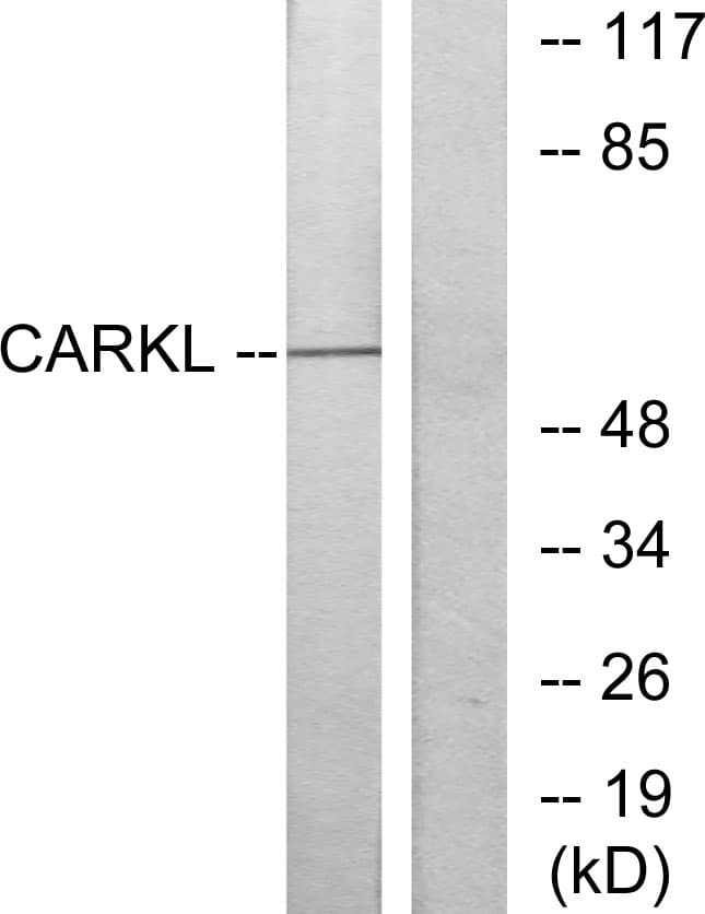 SHPK / CARKL Antibody (aa31-80)