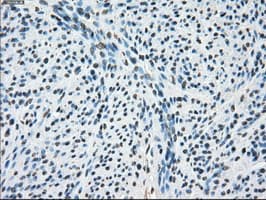 CYPOR / POR Antibody (clone OTI4G2)