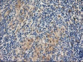 LIMK1 / LIMK Antibody (clone OTI2A11)
