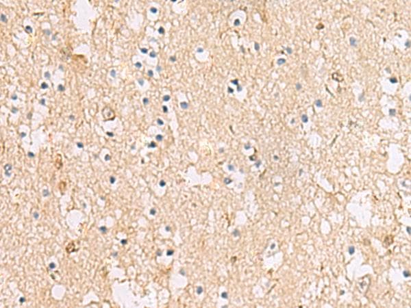 Polyclonal Rabbit anti-Human PLEKHF2 Antibody (IHC, WB)