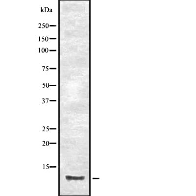 CCL23 / MIP3 Antibody