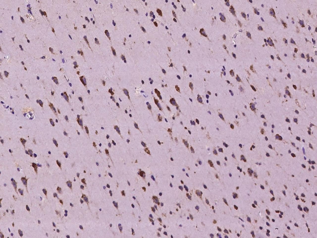 Polyclonal Rabbit anti-Human SLC35F6 Antibody (IHC)
