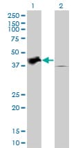 TRIB2 Antibody (clone 1B1)