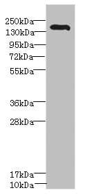 ROBO2 Antibody
