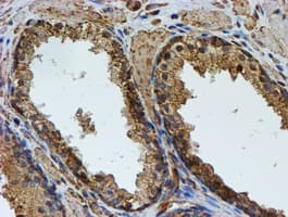 PSMB9 Antibody (aa21-219, clone OTI1D1)