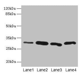 CA3 / Carbonic Anhydrase III Antibody