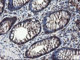 SKIL / SNO / SnoN Antibody (clone OTI3E9)