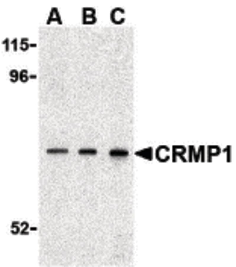 IHC-plus™ CRMP1 Antibody