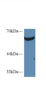 PKM / Pyruvate Kinase, Muscle Antibody (aa141-248)
