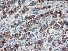 RPN1 / Ribophorin I Antibody (clone OTI3H3)
