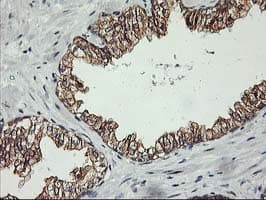 Monoclonal Mouse anti-Human PDSS2 / DLP1 Antibody (clone OTI1E9, IHC, IF, WB)