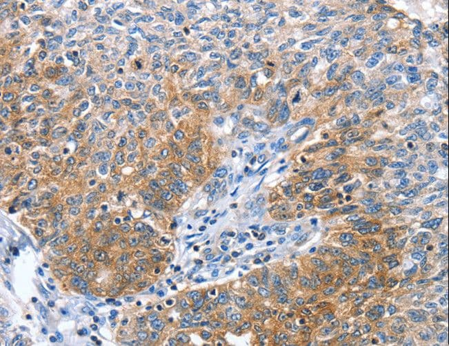 CGB / hCG Beta Antibody