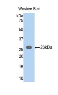 LPO / Lactoperoxidase Antibody (aa305-498)