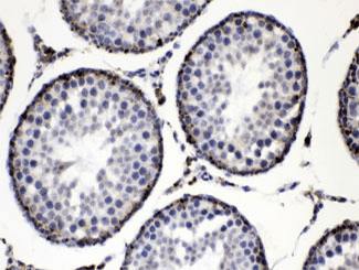 PLIN2 / ADFP / Adipophilin Antibody
