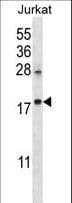 Polyclonal Rabbit anti-Human KRTAP25-1 Antibody (aa73-102, WB)