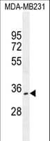 OTUD6A Antibody (aa72-100)
