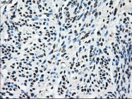 KIAA0153 / TTLL12 Antibody (clone OTI7F11)