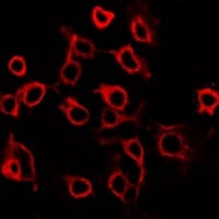 PTGER2 / EP2 Antibody (C-Terminus)