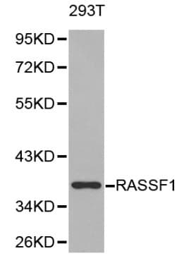 Polyclonal Rabbit anti-Human RASSF1 / RASSF1A Antibody (IHC, WB)