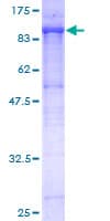 Human CD105 Protein (Recombinant GST)