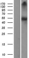 DDC / DOPA Decarboxylase Protein (Over-Expression Lysate Myc-DDK (Flag))