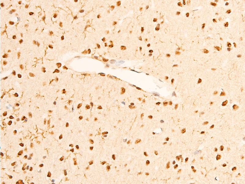 Polyclonal Rabbit anti-Human NTRK1 / TrkA Antibody (phospho-Tyr680,phospho-Tyr681, IHC, WB)