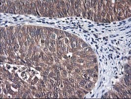 ALS2CR1 / NIF3L1 Antibody (clone OTI4B5)