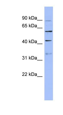 PRPF4 Antibody (aa71-120)