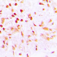 Polyclonal Rabbit anti-Human CDCA2 Antibody (Internal, IHC, WB)