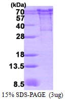 Human CHGA / Chromogranin A Protein (Recombinant His)