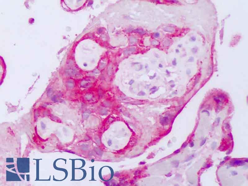 PathPlus™ Polyclonal Rabbit anti-Human EGFR Antibody (C-Terminus, IHC)