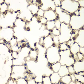 BCAP / PHF11 Antibody
