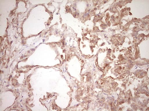 SPP1 / Osteopontin Antibody (aa17-314, clone OTI5E4)