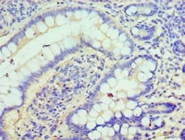 CLIC1 / NCC27 Antibody (aa42-241)