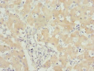 Polyclonal Rabbit anti-Human USP26 Antibody (IHC, WB)