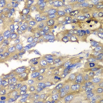 Polyclonal Rabbit anti-Human SLC25A4 / ANT Antibody (IHC, WB)