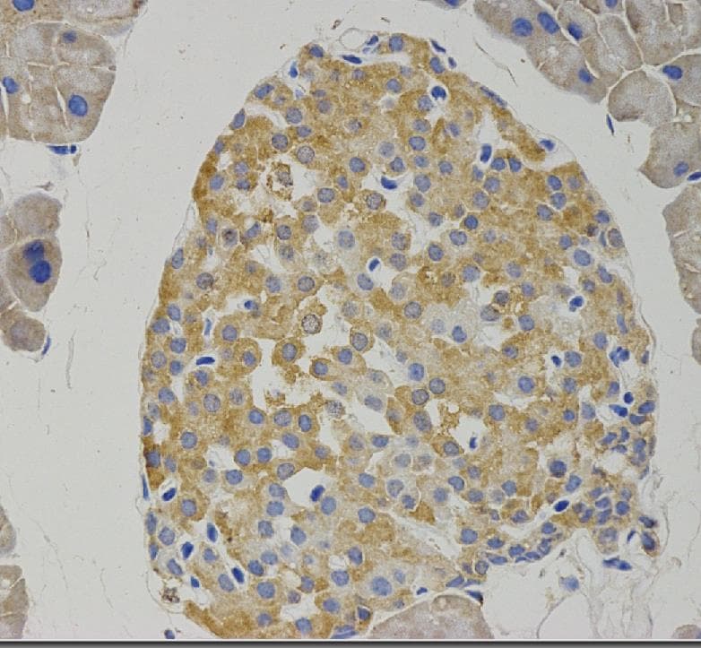 GABBR1 / GABA B Receptor 1 Antibody