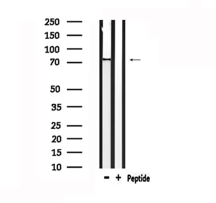 FZD3 / Frizzled 3 Antibody