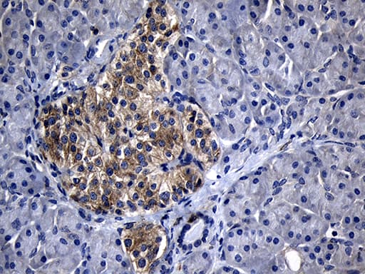SLC9A1BP / CHP Antibody (clone OTI4B9)