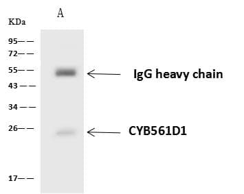 Polyclonal Rabbit anti-Human CYB561D1 Antibody (WB)