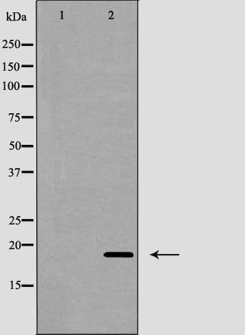 Polyclonal Rabbit anti-Human IFN Gamma / Interferon Gamma Antibody (IHC, WB)